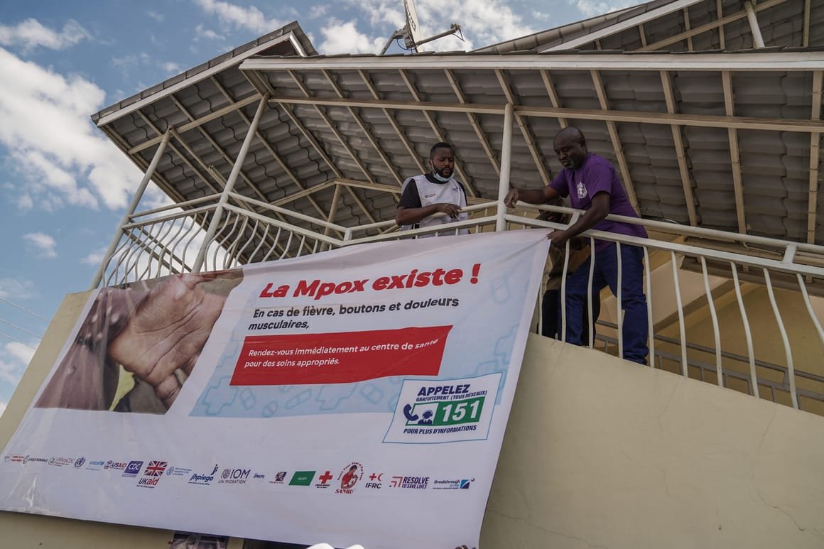 DRCONGO-HEALTH-VIRUS-MPOX